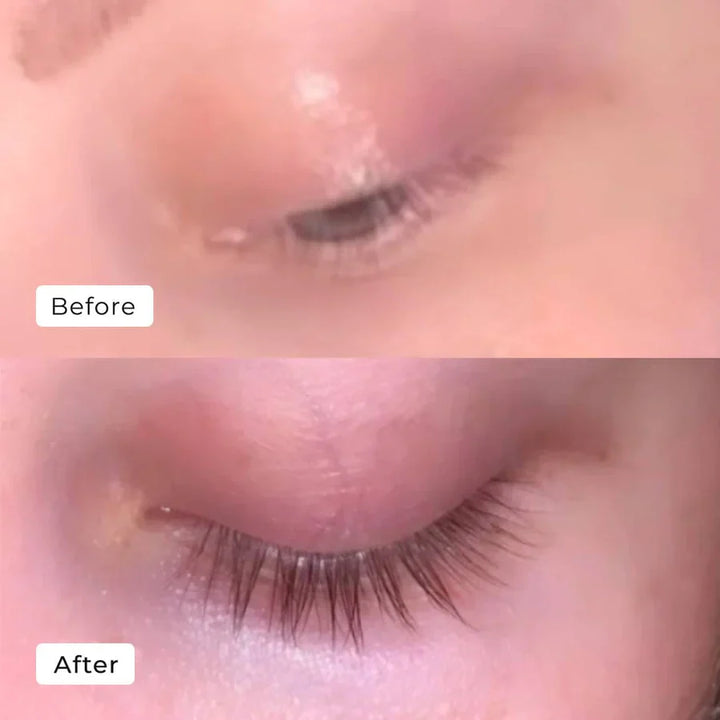 VoluLash™ Eyelash Growth Serum | 1 + 1 GRATIS